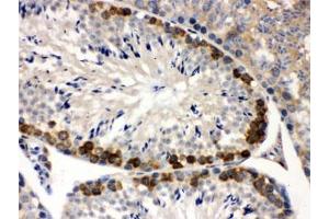 IHC testing of FFPE mouse testis with YB1 antibody. (YBX1 抗体)