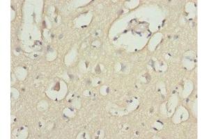 Immunohistochemistry of paraffin-embedded human brain tissue using ABIN7143362 at dilution of 1:100 (MOCS3 抗体  (AA 271-460))