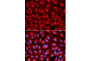 Immunofluorescence analysis of U2OS cell using TFAM antibody. (TFAM 抗体)