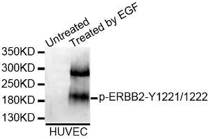 Western blot analysis of extracts of HUVEC cell line, using Phospho-ERBB2-Y1221/1222 antibody (ABIN5995602). (ErbB2/Her2 抗体  (pTyr1221, pTyr1222))