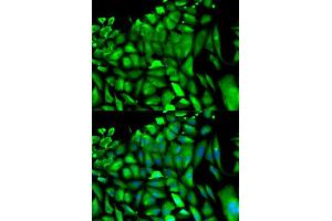 Immunofluorescence analysis of HeLa cells using PGK1 antibody (ABIN5971017). (PGK1 抗体)