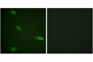 Immunofluorescence analysis of NIH-3T3 cells, using MDM2 (Ab-166) Antibody. (MDM2 抗体  (AA 132-181))