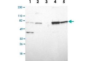 Western Blot analysis of Lane 1: RT-4, Lane 2: U-251MG sp, Lane 3: human plasma (IgG/HSA depleted), Lane 4: human liver and Lane 5: human tonsil lysates with ASMTL polyclonal antibody . (ASMTL 抗体)