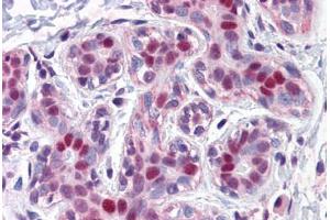 Human Breast: Formalin-Fixed, Paraffin-Embedded (FFPE) (LMO4 抗体  (AA 1-166))