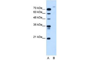 USP48 antibody used at 2. (USP48 抗体  (Middle Region))