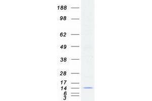 Validation with Western Blot
