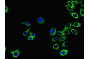Immunofluorescent analysis of A549 cells using ABIN7151827 at dilution of 1:100 and Alexa Fluor 488-congugated AffiniPure Goat Anti-Rabbit IgG(H+L)