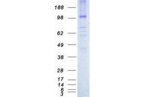 Western Blotting (WB) image for tyrosine Kinase with Immunoglobulin-Like and EGF-Like Domains 1 (TIE1) protein (Myc-DYKDDDDK Tag) (ABIN2733705)