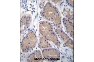 CA1 Antibody (N-term) (ABIN656574 and ABIN2845835) immunohistochemistry analysis in formalin fixed and paraffin embedded human stomach tissue followed by peroxidase conjugation of the secondary antibody and DAB staining. (CA1 抗体  (N-Term))