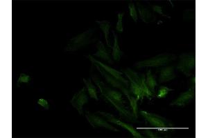 Immunofluorescence of monoclonal antibody to ODF2 on HeLa cell. (ODF2 抗体  (AA 706-804))