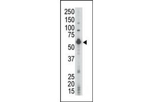 Western Blotting (WB) image for anti-Lymphocyte-Specific Protein tyrosine Kinase (LCK) (N-Term) antibody (ABIN359986) (LCK 抗体  (N-Term))