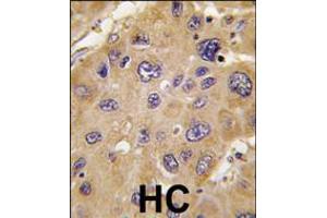 Immunohistochemistry (IHC) image for anti-Aldehyde Dehydrogenase 6 Family, Member A1 (ALDH6A1) (AA 367-396), (C-Term) antibody (ABIN5530270)