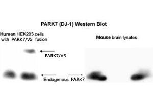 Western blot analysis of PARK7 in 293 cells and mouse brain lysates with PARK7 polyclonal antibody . (PARK7/DJ1 抗体  (AA 150-189))