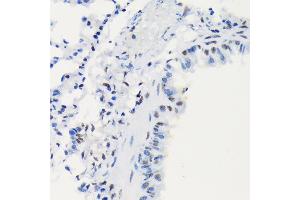 Immunohistochemistry (IHC) image for anti-Ligase I, DNA, ATP-Dependent (LIG1) antibody (ABIN7268251)