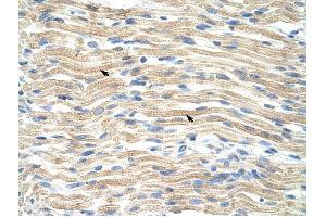 EXOSC6 antibody was used for immunohistochemistry at a concentration of 4-8 ug/ml to stain Skeletal muscle cells (arrows) in Human Muscle. (EXOSC6 抗体  (N-Term))