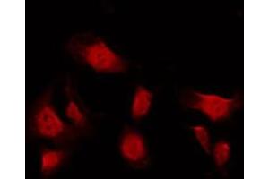 ABIN6275314 staining A549 by IF/ICC. (NUMA1 抗体  (N-Term))