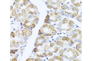Immunohistochemistry of paraffin-embedded Human stomach using PIK3CA Polyclonal Antibody at dilution of 1:100 (40x lens). (PIK3CA 抗体)