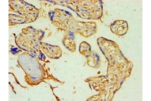 Immunohistochemistry of paraffin-embedded human placenta tissue using ABIN7170995 at dilution of 1:100 (SOCS2 抗体  (AA 1-198))