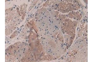 Detection of MYH16 in Human Esophagus Tissue using Polyclonal Antibody to Myosin Heavy Chain 16 (MYH16)