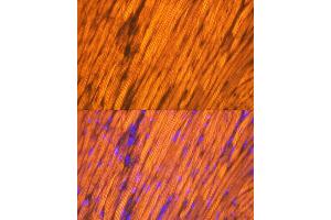 Immunofluorescence (IF) image for anti-Tropomyosin 1 (Alpha) (TPM1) antibody (ABIN7271013)