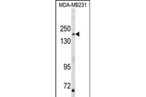 Western blot analysis of TBC1D4 Antibody (N-term) (ABIN652462 and ABIN2842314) in MDA-M cell line lysates (35 μg/lane). (TBC1D4 抗体  (N-Term))