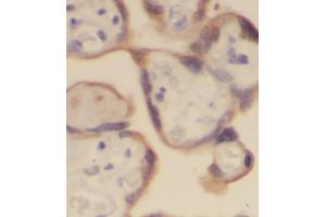 IHC analysis of paraffin-embedded human placenta, using PLAP antibody (1/100 dilution). (PLAP 抗体)