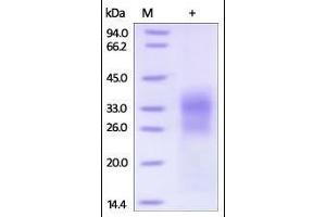 Human SOST, His Tag on SDS-PAGE under reducing (R) condition. (Sclerostin Protein (SOST) (AA 24-213) (His tag))