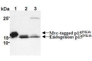 Western Blotting (WB) image for anti-Cyclin-Dependent Kinase Inhibitor 2B (p15, Inhibits CDK4) (CDKN2B) antibody (ABIN1449282) (CDKN2B 抗体)