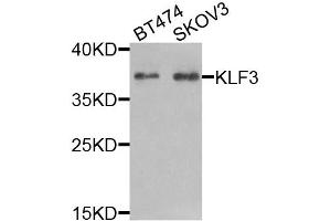Western blot analysis of extracts of various cell lines, using KLF3 antibody (ABIN5974328) at 1/1000 dilution. (KLF3 抗体)