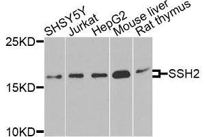 Western blot analysis of extracts of various cells, using SSH2 antibody. (SSH2 抗体)