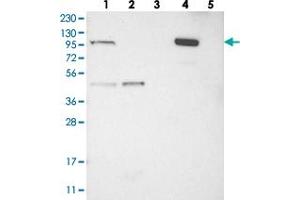 Western blot analysis of Lane 1: RT-4, Lane 2: U-251 MG, Lane 3: Human Plasma, Lane 4: Liver, Lane 5: Tonsil with C1orf112 polyclonal antibody . (C1orf112 抗体)