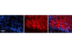 Rabbit Anti-CSF1 Antibody    Formalin Fixed Paraffin Embedded Tissue: Human Adult liver  Observed Staining: Cytoplasmic Primary Antibody Concentration: 1:600 Secondary Antibody: Donkey anti-Rabbit-Cy2/3 Secondary Antibody Concentration: 1:200 Magnification: 20X Exposure Time: 0. (M-CSF/CSF1 抗体  (N-Term))