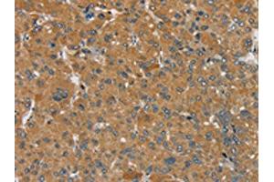 Immunohistochemistry (IHC) image for anti-Sema Domain, Transmembrane Domain (TM), and Cytoplasmic Domain, (Semaphorin) 6D (SEMA6D) antibody (ABIN7192302)