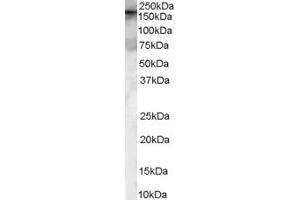 Western Blotting (WB) image for anti-Chromosome 14 Open Reading Frame 119 (C14ORF119) (N-Term) antibody (ABIN2787045) (C14ORF119 抗体  (N-Term))