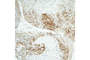 Immunohistochemistry (IHC) image for anti-Claudin 1 (CLDN1) (C-Term) antibody (ABIN7453966)