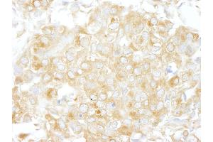 anti-rho GTPase Activating Protein 1 (ARHGAP1) (AA 1-50) antibody
