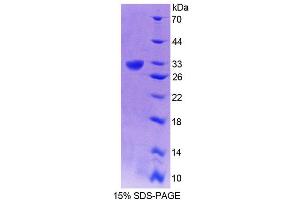 SDS-PAGE analysis of Human GRIK2 Protein. (GRIK2 蛋白)