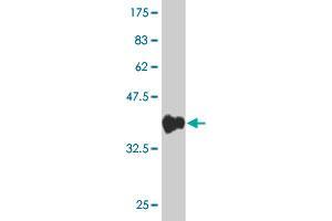 Western Blot detection against Immunogen (36. (ZNF496 抗体  (AA 485-585))