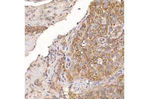 Immunohistochemistry (IHC) image for anti-Thioredoxin Domain Containing 12 (Endoplasmic Reticulum) (TXNDC12) antibody (ABIN7270799)