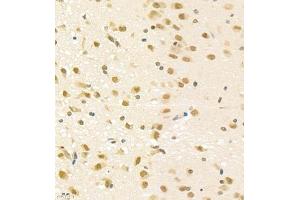 Immunohistochemistry of paraffin embedded rat brain using PGBD5 (ABIN7075082) at dilution of 1:2000 (400x lens) (PGBD5 抗体)