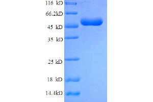 SDS-PAGE (SDS) image for Heat Shock 22kDa Protein 8 (HSPB8) (AA 2-213) protein (GST tag) (ABIN5709655) (HSPB8 Protein (AA 2-213) (GST tag))