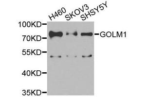 Western blot analysis of extracts of various cell lines, using GOLM1 antibody. (GOLM1 抗体  (AA 112-401))