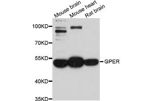 Western blot analysis of extracts of various cell lines, using GPER1 antibody (ABIN4903806) at 1:1000 dilution. (GPER 抗体)