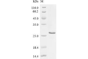 Secreted phosphoprotein 1 (SPP1) (AA 169-314) protein (His tag)