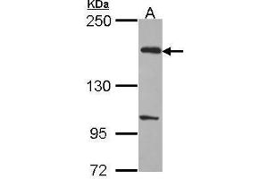 WB Image Sample (30 ug of whole cell lysate) A: H1299 5% SDS PAGE EVC2 antibody antibody diluted at 1:1000 (EVC2 抗体  (C-Term))