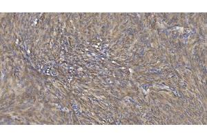 IHC analysis of Alpha B Crystallin/CRYAB using anti-Alpha B Crystallin/CRYAB antibody (ABIN7601209).