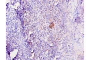 Immunohistochemistry of paraffin-embedded human tonsil tissue using ABIN7179323 at dilution of 1:10 (IL12B 抗体  (AA 23-327))