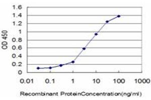 Detection limit for recombinant GST tagged KIAA2002 is approximately 0. (PEAK1 抗体  (AA 1151-1250))