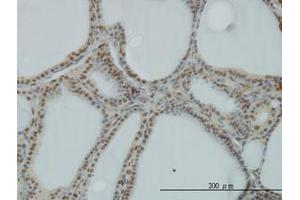 Image no. 1 for anti-Polymerase (RNA) I Polypeptide C, 30kDa (POLR1C) (AA 1-347) antibody (ABIN599083) (POLR1C 抗体  (AA 1-347))