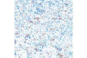 Immunohistochemistry of paraffin-embedded rat spleen using FGFR2 antibody.